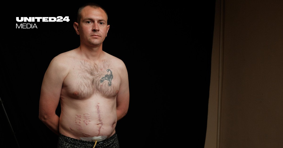 UN Reports Over 95% of Ukrainian POWs Face Torture and Sexual Violence in Russian Custody
