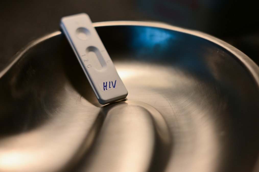 An illustrative photo of an HIV rapid test at the Berlin AIDS service organization. (Source: Getty Images)