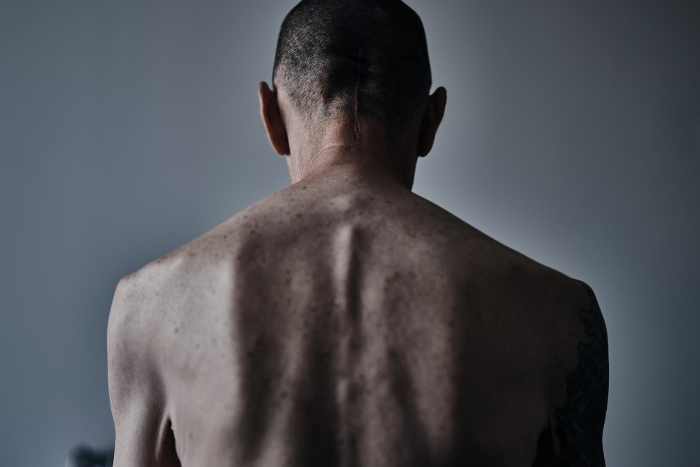 Russia Hides Tortured Ukrainian POWs From Red Cross, OSCE Investigation Finds