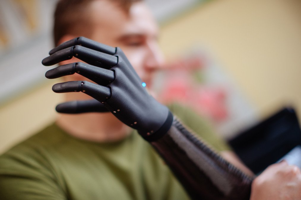Ukrainian Prosthetic Producer Raises $5 Million in Investment to Build World’s First Bionic Ecosystem