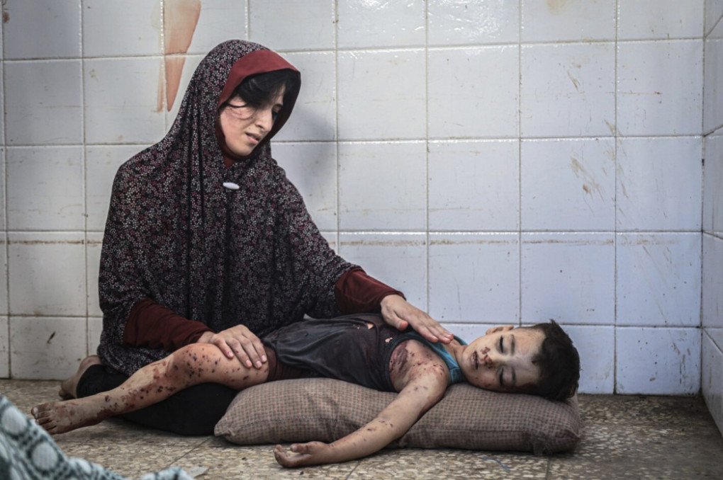 Saher Alghorra won the 1st Prize for the Photo Trophy – International Jury Awarded by Nikon. In this picture, a mother mourns her son, Ziad Mahmoud Ziad Saydam who was killed during an Israeli raid on a house in Nuseirat Camp. The family had fled to Rafah where they had spent two months moving from one place to another for safety, and then had fled Rafah to find refuge in Deir al-Balah, only for Ziad to lose his life in the attack. The morgue at Al-Aqsa Martyrs Hospital in Deir al-Balah, June 24, 2024. (Photo: Saher Alghorra / Zuma Press)