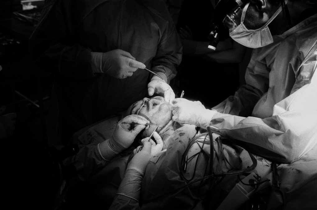 Operating under headlamps and bright surgical lights, Ukrainian and American doctors carry out a complex facial reconstruction procedure on a wounded soldier. Photo: Josh Olley Operating under headlamps and bright surgical lights, Ukrainian and American doctors carry out a complex facial reconstruction procedure on a wounded soldier. Photo: Josh Olley