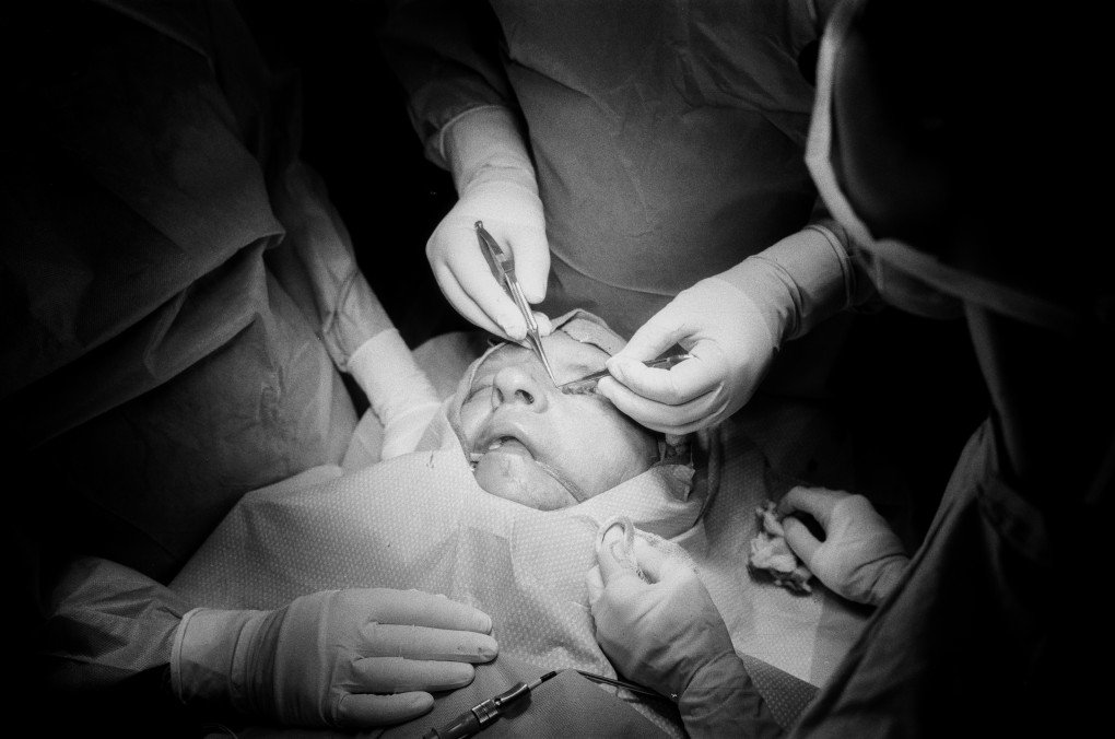 Surgeons perform a delicate procedure to reconstruct a soldier’s upper eyelid, one of many steps in restoring facial function and dignity. Photo: Josh Olley Surgeons perform a delicate procedure to reconstruct a soldier’s upper eyelid, one of many steps in restoring facial function and dignity. Photo: Josh Olley