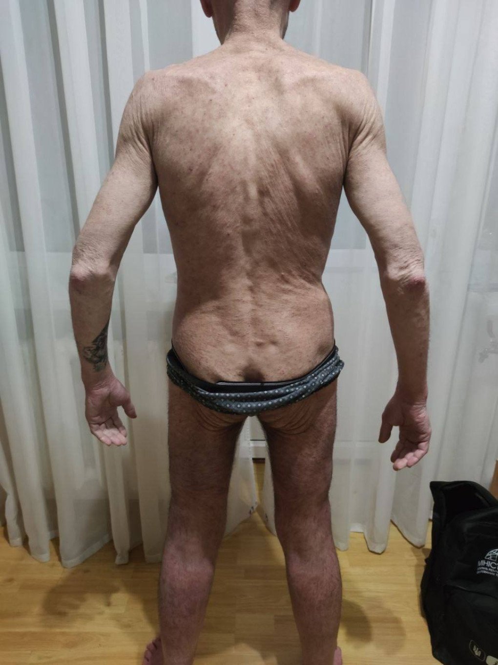 Oleksandr Savov documents the state of his body after undergoing torture and abuse in Russian captivity. Family archive Oleksandr Savov documents the state of his body after undergoing torture and abuse in Russian captivity. Family archive