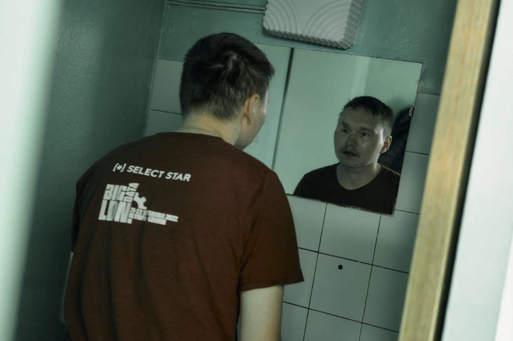 Serhii, de 23 años, se prepara para una cirugía que durará entre 5 y 6 horas. Foto: Josh Olley/ UNITED24 Media