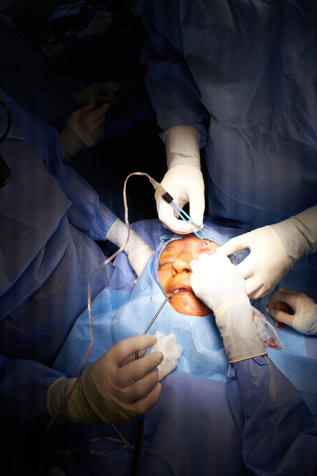 In one of the most delicate phases of reconstruction, surgeons operate on a patient’s eye socket, repairing damage caused by shrapnel and blast injuries. Photo: Josh Olley