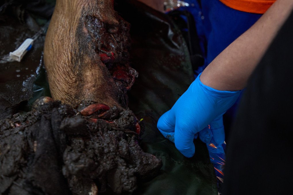 Wounded soldiers’ legs before the surgeons’ diagnosis. Photo Mykyta Shandyba/UNITED24 Media. Injured legs before surgery in Ukraine's frontline