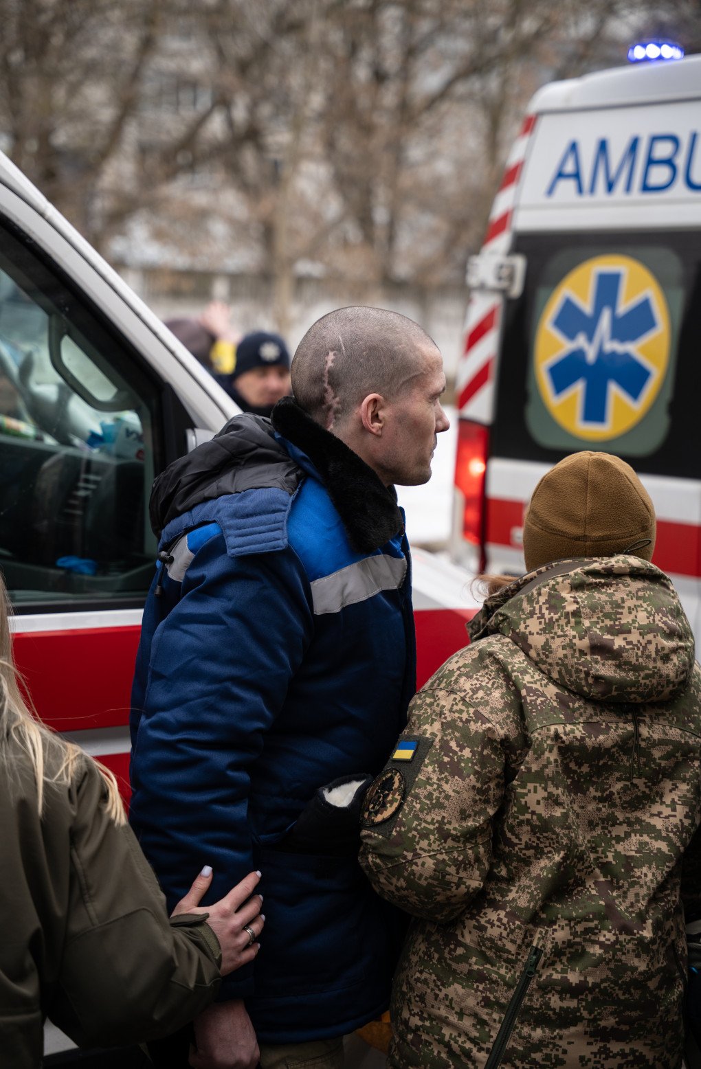A big scar is seen on the head of one of the released Ukrainian serviceman near one the ambulances during the 200 for 200 prisoner exchange on March 5, 2025, undisclosed location, Ukraine. Photo by Dmytro Ivanov/UNITED24 Media