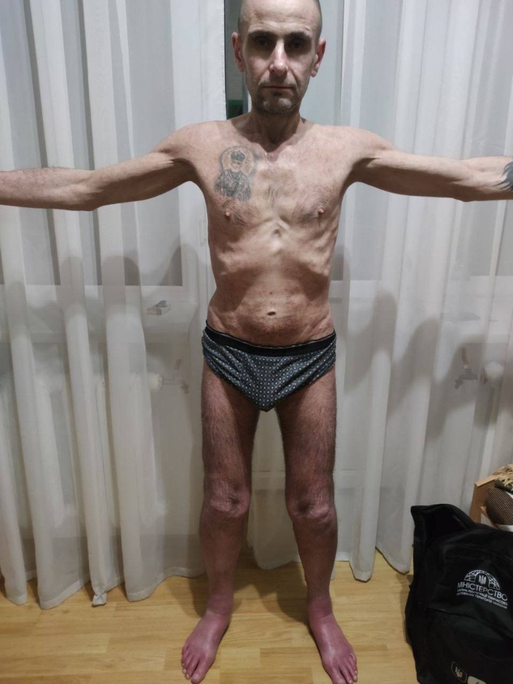 Oleksandr Savov shows the state of his body after spending two years, ten months and three days in Russian captivity. Family archive Oleksandr Savov shows the state of his body after spending two years, ten months and three days in Russian captivity. Family archive