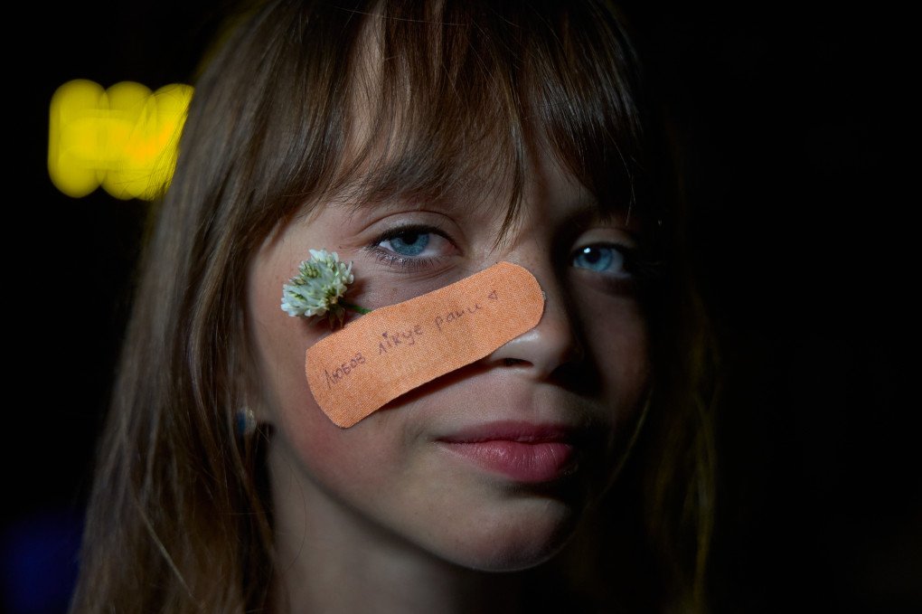 Ivanka, 9 years old. She dreams of becoming a singer, a model, and a famous photographer. The bandage reads “Love heals wounds.” A slogan created by one of the girls participating in Gen.Camp. Ivanka, 9 years old. She dreams of becoming a singer, a model, and a famous photographer. The bandage reads “Love heals wounds.” A slogan created by one of the girls participating in Gen.Camp.