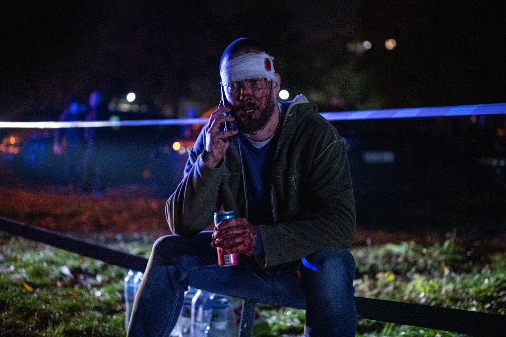An injured man is seen talking of the phone near the residential building damaged by the Russian ballistic missile as firefighters battle the blaze in Kyiv's Desnianskyi district on October 14, 2026. (Photo by Danylo Antoniuk via Getty Images)