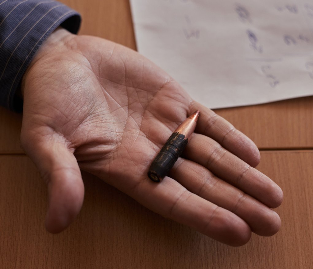 Dr. Hnilitsky holds a bullet that fell from the sky as he got into his car one morning on his way to the hospital. (Source: UNITED24 Media/Joshua Olley) Dr. Hnilitsky holds a bullet that fell from the sky as he got into his car one morning on his way to the hospital. (Source: UNITED24 Media/Joshua Olley)