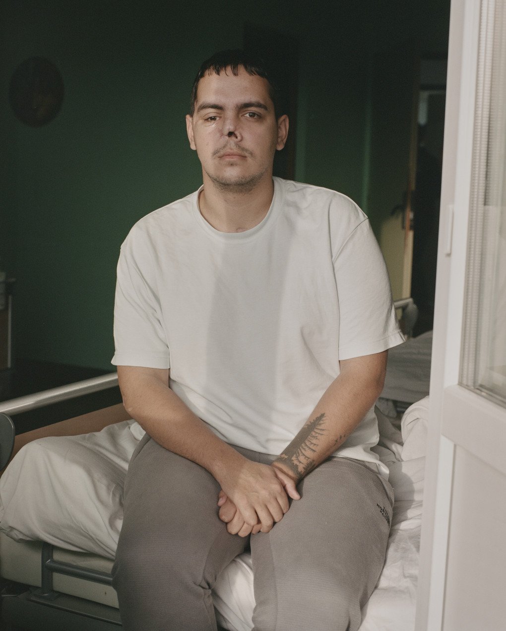 Según el Dr. Adamson, muchos soldados necesitan al menos dos, tres, cuatro y, a veces, hasta cinco procedimientos diferentes. Foto: Josh Olley/ UNITED24 Media