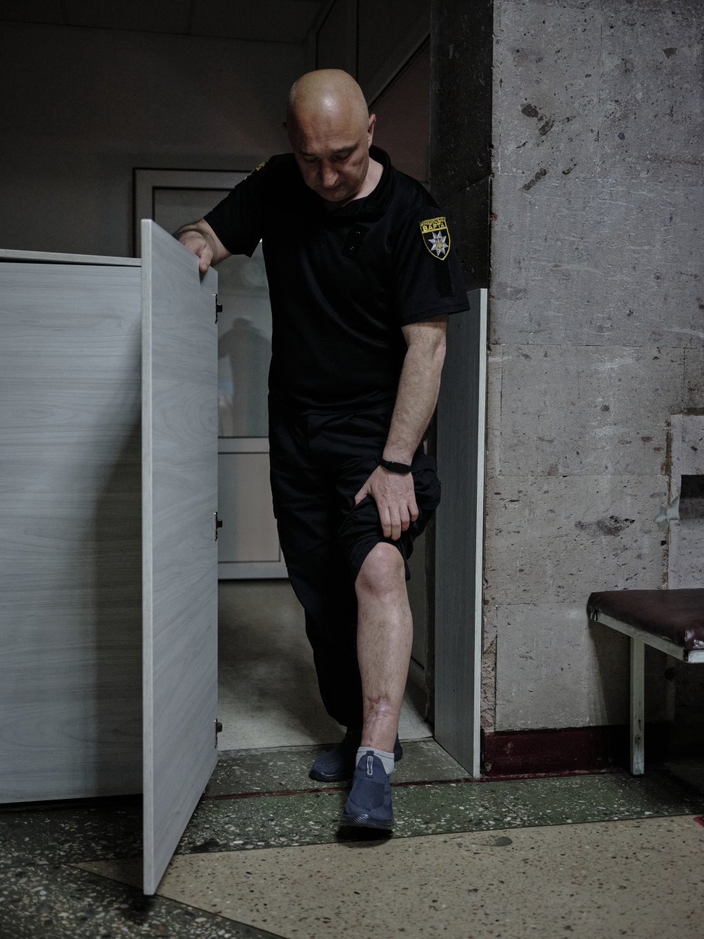 Dmytro Huzhva, showing his leg injury. Photo: Josh Olley