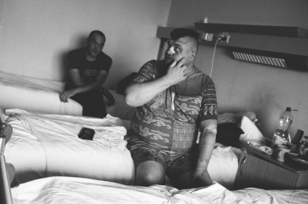 Artem resultó herido en febrero de 2023 cuando un proyectil de mortero de 120 mm disparado por las fuerzas rusas impactó la trinchera en la que se encontraba. Foto: Josh Olley/ UNITED24 Media