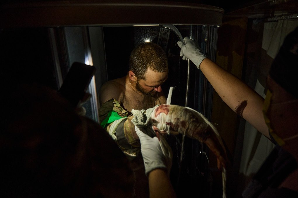 Medical examination and shower for a captured Russian soldier. (Photo: Mykyta Shandyba/UNITED24 Media) Medical examination and shower for a captured Russian soldier. (Photo: Mykyta Shandyba/UNITED24 Media)