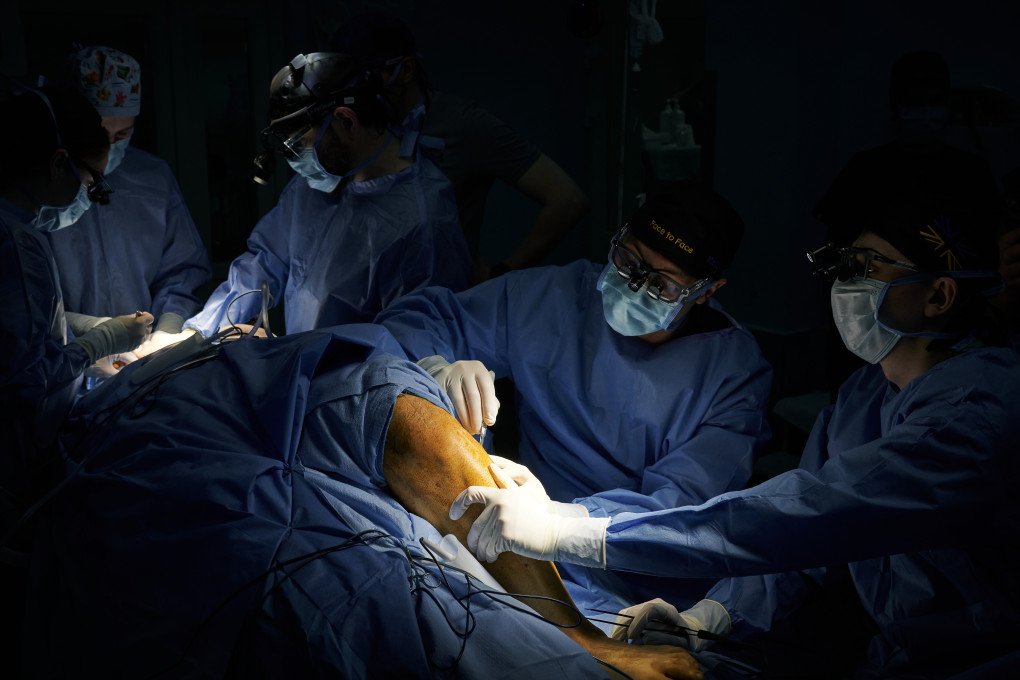 Surgeons harvest a section of the fibula bone to use in facial reconstruction. Photo: Josh Olley Surgeons harvest a section of the fibula bone to use in facial reconstruction. Photo: Josh Olley