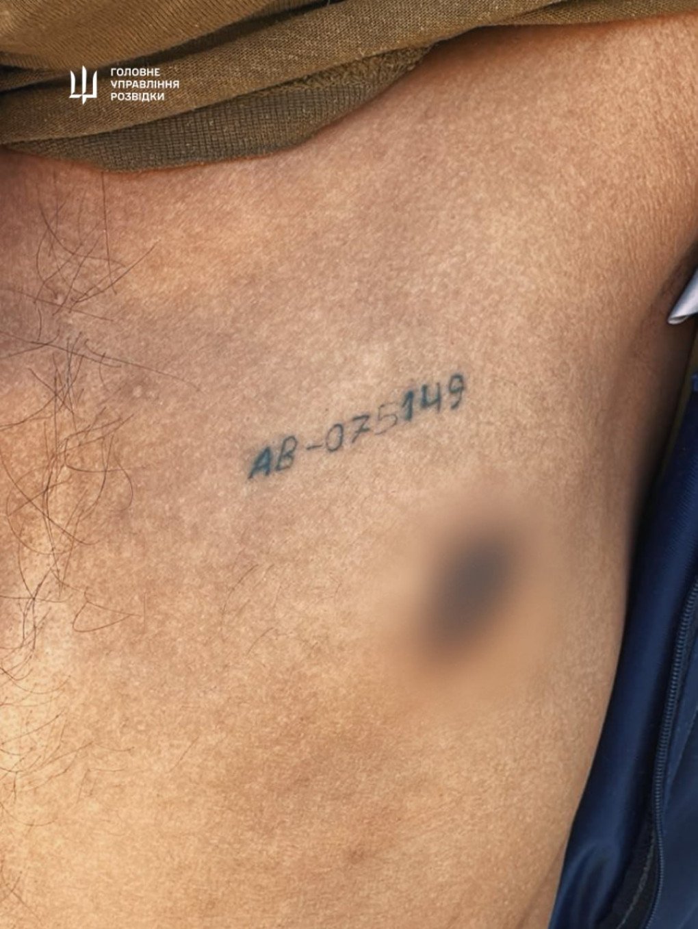 An identification number marked on the skin of a foreign recruit serving in the Russian military. (Source: HUR)