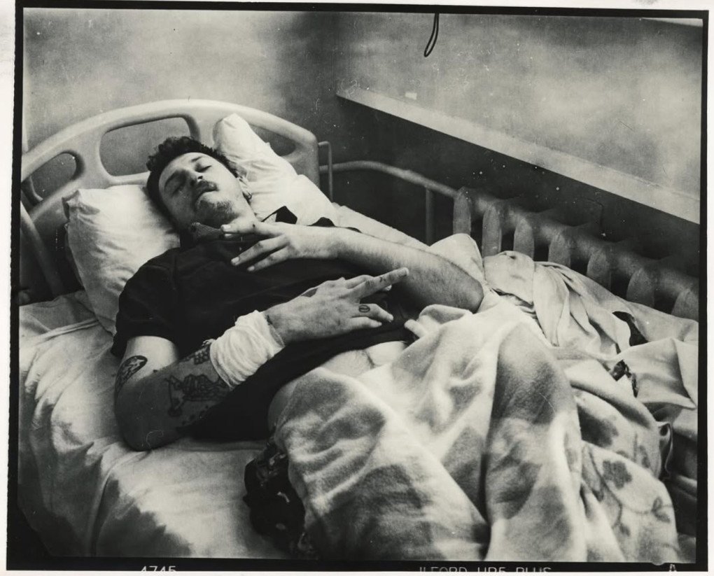 Hryhorii “George” Ivanchenko, hospitalized after his leg amputation caused by a Russian FPV drone strike on the car he shared with French photojournalist Anthony Lallikan, who was killed instantly. (Source: Vladyslav Krasnoshchok)