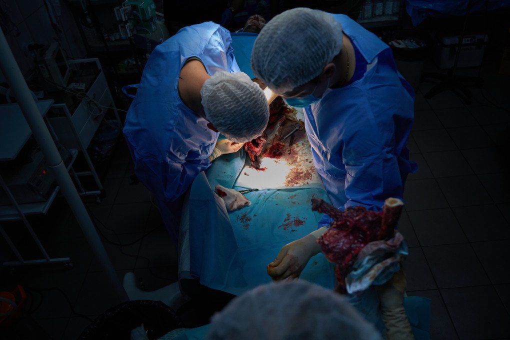 Surgeons from the 3rd Army Corps’ 4th Separate Medical Battalion operate on an exploded foot. Photo Mykyta Shandyba/UNITED24 Media Emergency foot surgery in frontline Ukraine