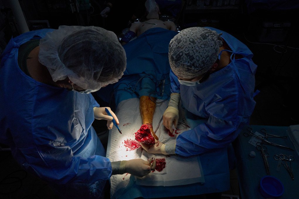 Surgeons from the 3rd Army Corps’ 4th Separate Medical Battalion operate on an exploded foot. Photo Mykyta Shandyba/UNITED24 Media Frontline surgeons operate in Ukraine