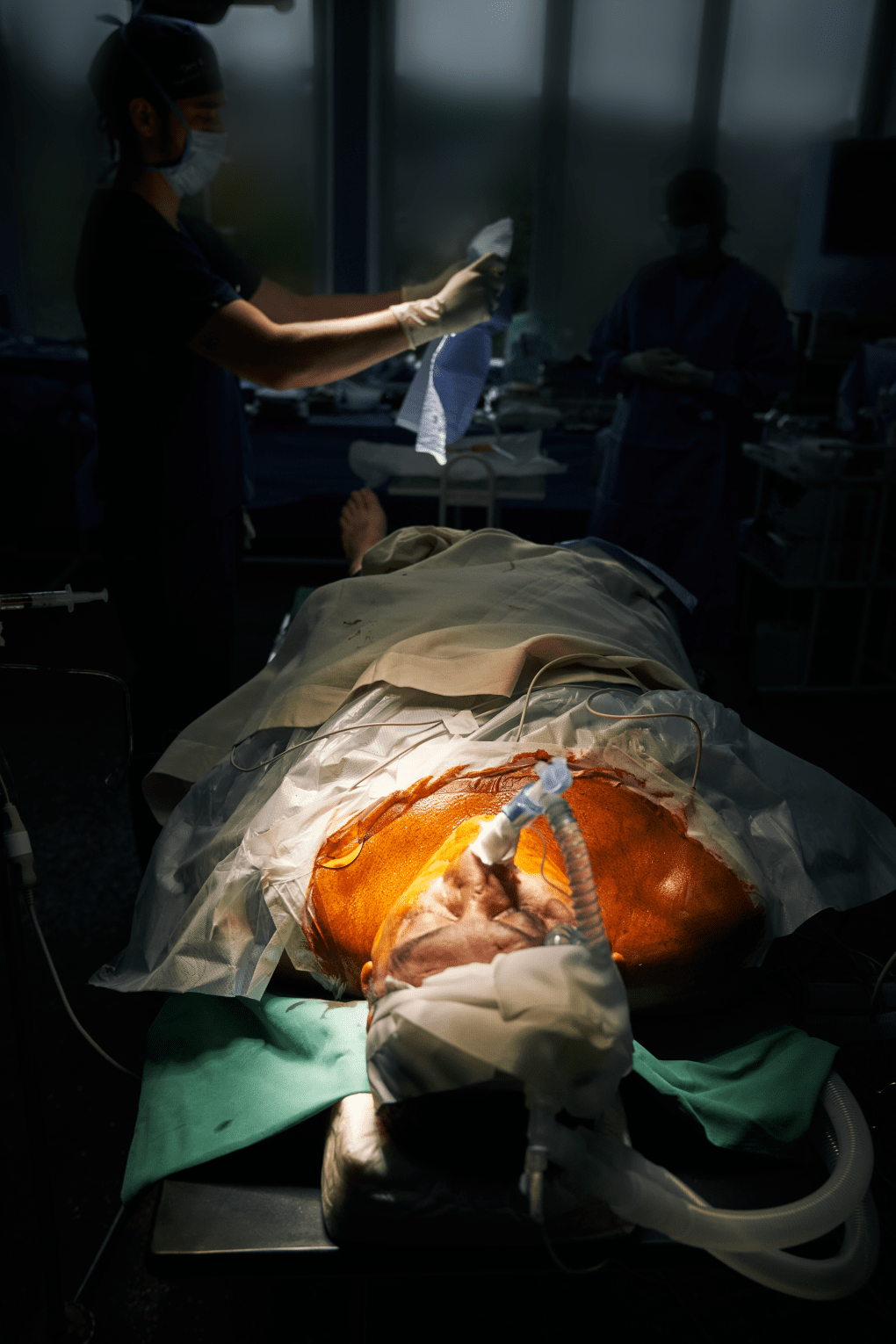 A Ukrainian soldier lies prepped for facial reconstruction. Photo: Josh Olley