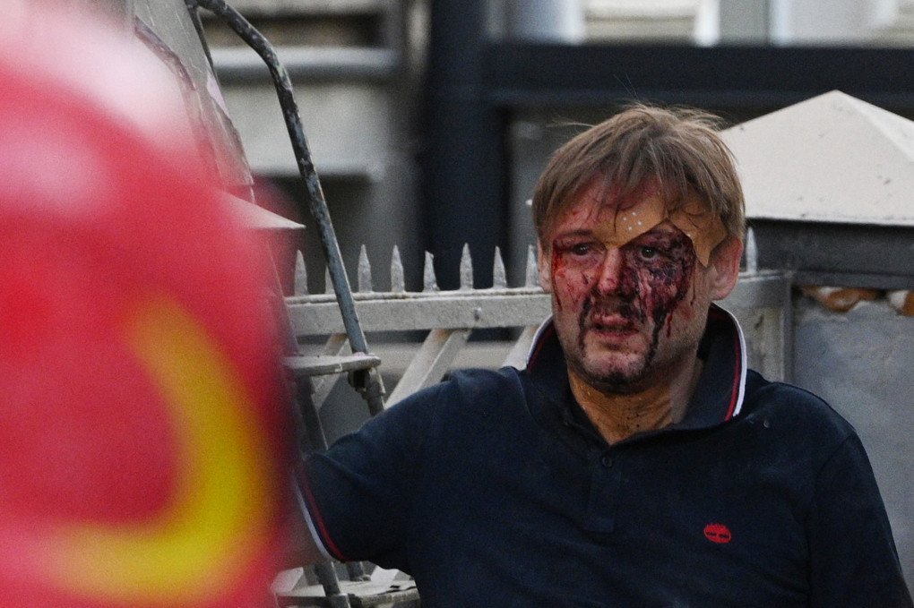 Injured local resident Yaroslav Bazylevych reacts as his three daughters and their mother were killed in Russia’s missile attack in Lviv on September 4, 2024. (Photo by YURIY DYACHYSHYN/AFP via Getty Images) Injured local resident Yaroslav Bazylevych reacts as his three daughters and their mother were killed in Russia’s missile attack in Lviv on September 4, 2024. (Photo by YURIY DYACHYSHYN/AFP via Getty Images)