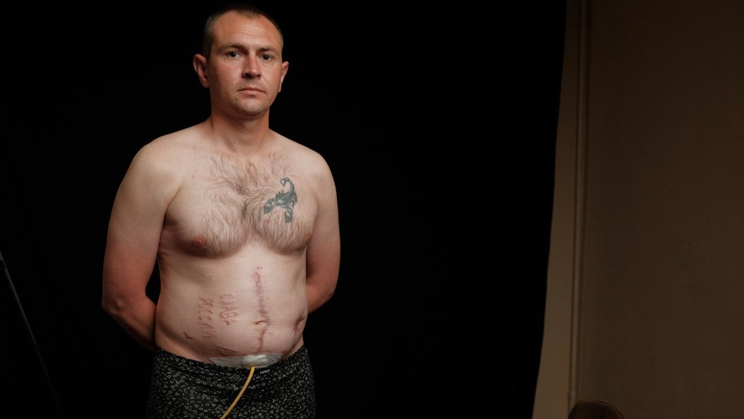 Over 95% of Ukrainian POWs Face Sexual Violence or Torture in Russian Custody, UN Reports