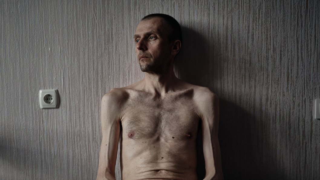 Ucrania documenta 695 métodos de tortura rusos y el asesinato de 406 prisioneros de guerra
