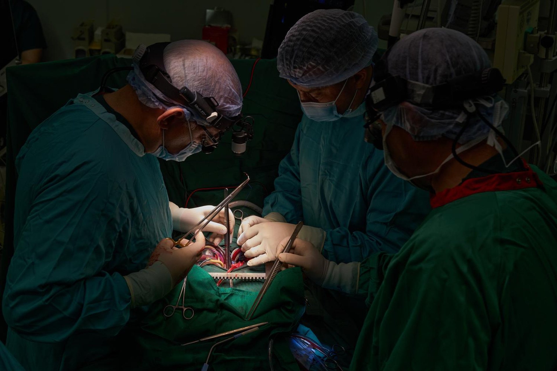 Illuminated by specialized surgical headlamps, renowned cardiac surgeon Dr. Borys Todurov leads his team through the meticulous process of suturing the donor heart into the recipient. This is the culmination of the intense, multi-city race against time. Every stitch must be flawless as the team works in the dimly lit theater, channeling years of specialized experience to give a patient a second lease on life amidst the ongoing challenges facing Ukraine's healthcare system. (Photo: Mykyta Shandyba / UNITED24 Media) Dr. Borys Todurov and a team of cardiac surgeons performing a heart transplant surgery on a patient in a Kyiv operating room.