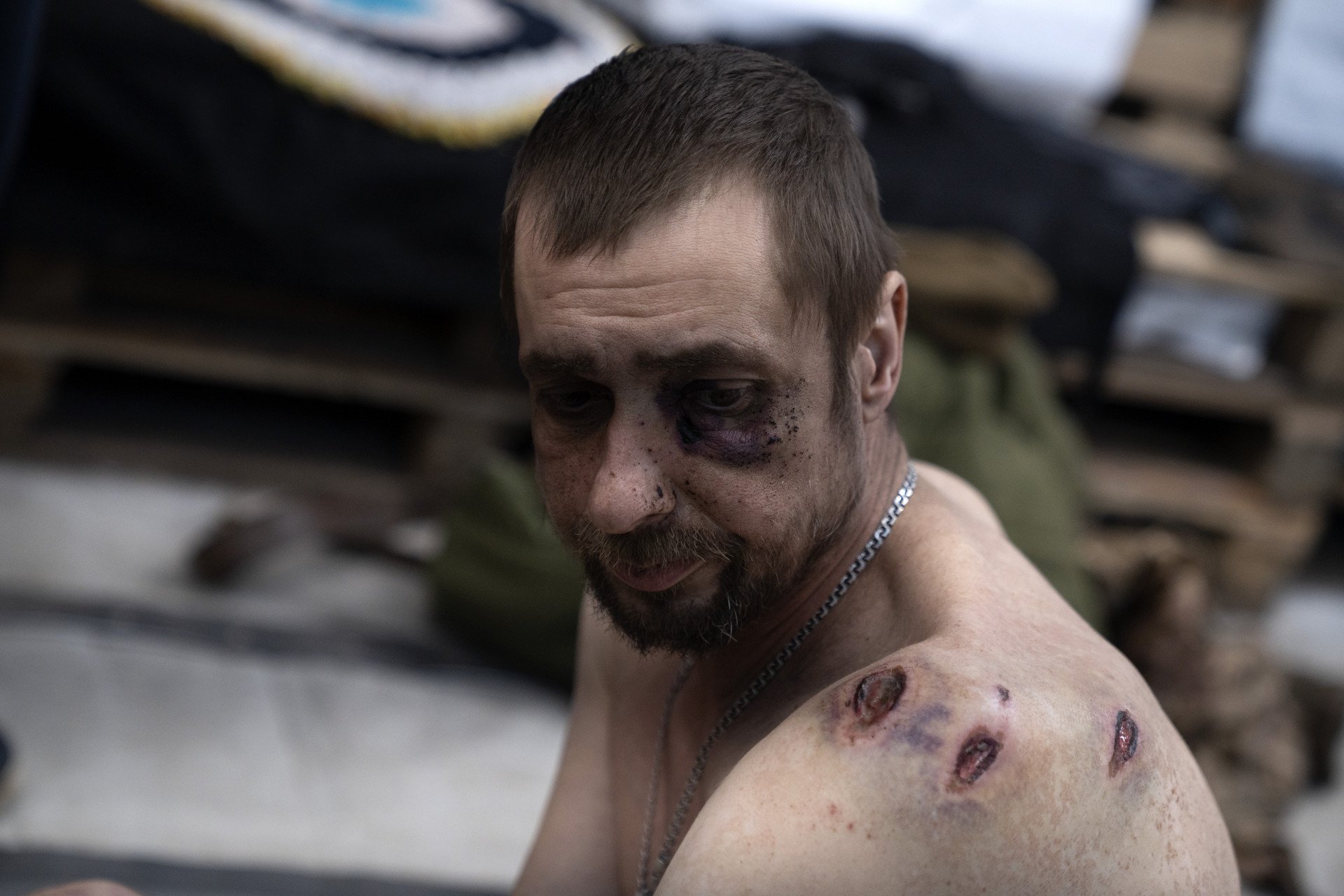 MAR 16 — Wounded Ukrainian soldiers receive treatment at a medical stabilization point in the Donetsk region. Medics from the 3rd Operational Spartan Brigade “Petro Bolbochan” fight to save lives at a medical stabilization point near the frontline in Pokrovsk. (Photo by Jose Colon @josecolontoscano)