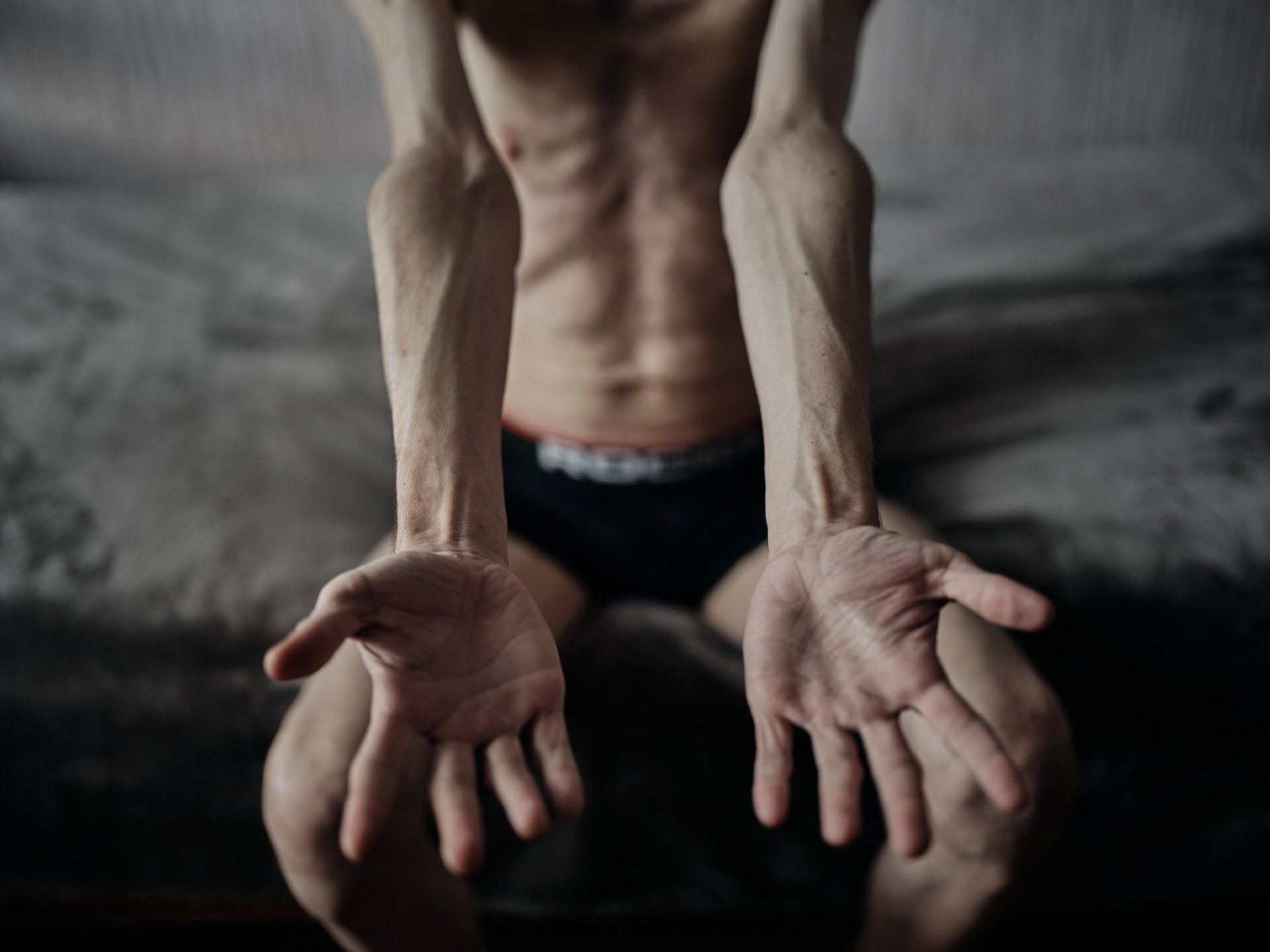 A Ukrainian soldier who was previously held captive poses for a portrait while undergoing rehabilitation