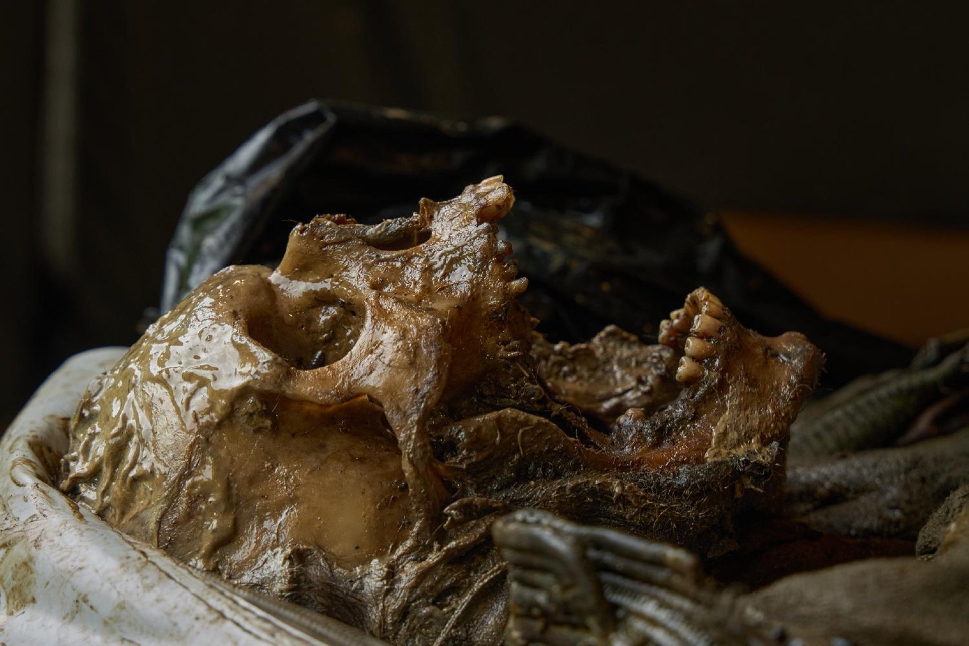 A close-up, profile photograph shows the heavily decomposed, skeletal skull of a human casualty tilted backward on a medical tray. The bone structure is slick, discolored, and coated with wet organic matter and dirt, revealing an empty eye socket and nasal cavity. The jaw is slightly open, exposing a row of intact teeth and traces of facial hair or clothing fibers beneath the chin against a dark, out-of-focus background.