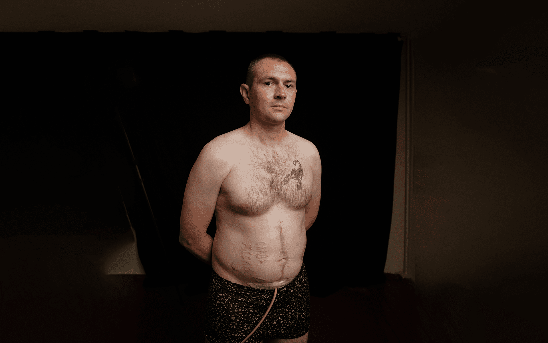 “They Burned ‘Glory to Russia’ Into My Stomach”: Ukrainian Soldier’s First Interview After Torture in Russian Captivity “They Burned ‘Glory to Russia’ Into My Stomach”: Ukrainian Soldier’s First Interview After Torture in Russian Captivity