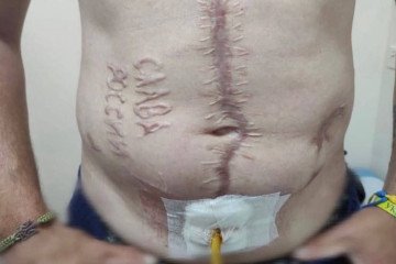 «Gloria a Rusia» grabado en un prisionero de guerra ucraniano: se confirma que la foto de la tortura es auténtica