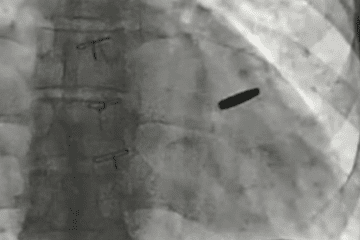 Ukrainian Soldier Survived Mariupol, Captivity—and Three Years With a Bullet in His Heart Ukrainian Soldier Survived Mariupol, Captivity—and Three Years With a Bullet in His Heart