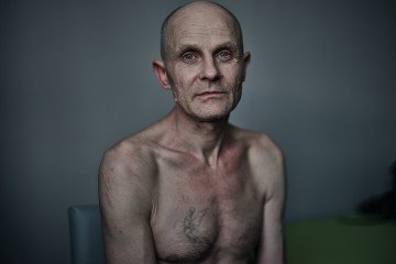 Ukrainian soldier who was previously held captive poses for a portrait while undergoing rehabilitation on June 6, 2024 in Ukraine. (Source: Getty Images)