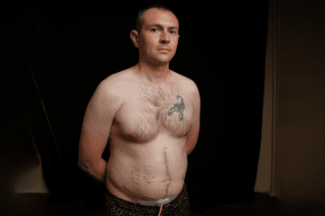 “They Burned ‘Glory to Russia’ Into My Stomach”: Ukrainian Soldier’s First Interview After Torture in Russian Captivity