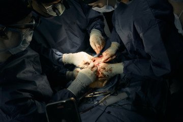 They Rebuild Faces of Ukrainian Soldiers Scarred by Russia’s War—Inside the Operating Rooms