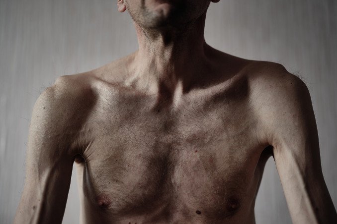 The “Gentleman’s Kit” of Torture: Firsthand Accounts Reveal Russia’s Brutal POW Abuse System The “Gentleman’s Kit” of Torture: Firsthand Accounts Reveal Russia’s Brutal POW Abuse System