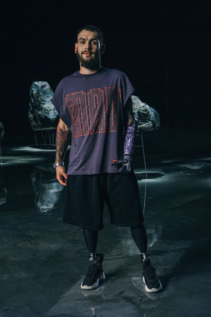 A rehabilitated serviceman proudly stands with prosthetic legs and a bionic arm. (Source: Amo Apps) A rehabilitated serviceman proudly stands with prosthetic legs and a bionic arm. (Source: Amo Apps)