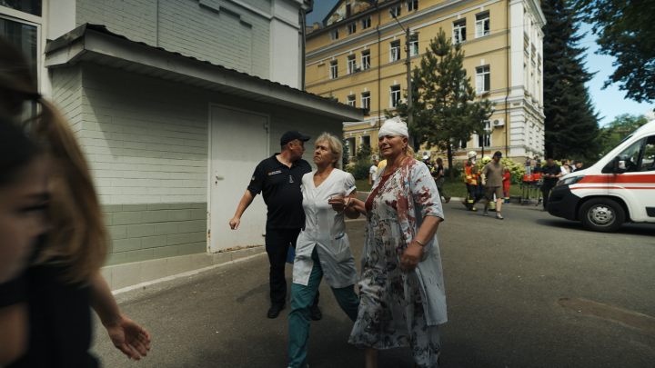 Medical personnel injured after Russia’s missile strike on Children's Hospital "Ohmatdyt", July 8, 2024. (Source: United24 Media) Medical personnel injured after Russia’s missile strike on Children's Hospital "Ohmatdyt", July 8, 2024. (Source: United24 Media)