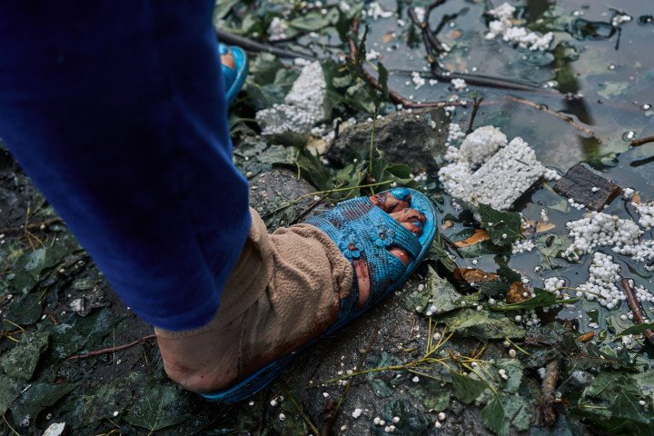 A woman’s bloodied foot wrapped in gauze, stepping through shattered glass and debris just hours after a Russian missile strike tore through her neighborhood. Kyiv, Ukraine. July 31, 2025. Photo by Josh Olley/UNITED24 Media