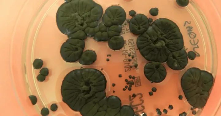 Melanized Cladosporium sphaerospermum fungus. (Source: Rui Tomé / Atlas of Mycology) Melanized Cladosporium sphaerospermum fungus. (Source: Rui Tomé / Atlas of Mycology)