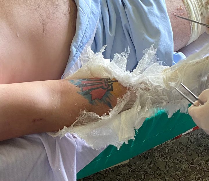 Tattoo on Mac Hughes's arm taken at a hospital, after he survived a drone attack. Photo submitted by Mac Hughes.