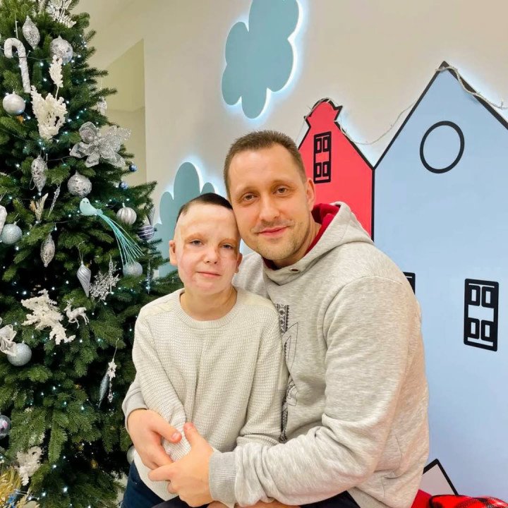 Eight-year-old Roman Oleksiv, who sustained burns to 45% of his body from a Russian missile strike on Vinnytsia in July 2022, took off his scar-reducing mask, December, 2024. (Source: yaroslavoleksiv / Instagram) Eight-year-old Roman Oleksiv, who sustained burns to 45% of his body from a Russian missile strike on Vinnytsia in July 2022, took off his scar-reducing mask, December, 2024. (Source: yaroslavoleksiv / Instagram)