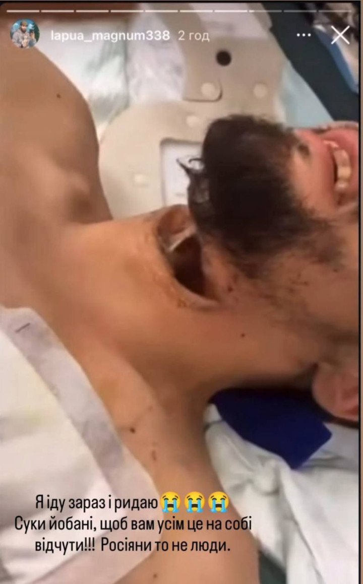 Close-up image of Ukrainian soldier Vladyslav’s neck injury after escaping Russian captivity. (Source: Instagram/@lapua_magnum338)