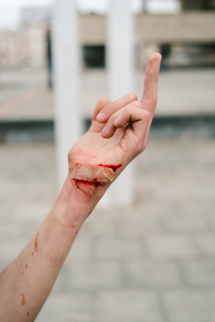 Skaters often injure themselves while trying tricks, and it is common to see blood on their hands, knees, or elbows. (Photo: Hironori Kodama) 