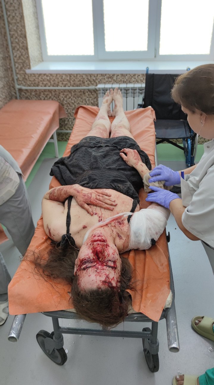 Yuliia getting first aid at the Mykolaiv hospital after being injured during a Russian Shahed drone strike on Mykolaiv, Ukraine. Photo provided by Yuliia’s family.