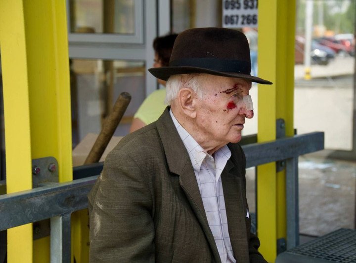 An injured man after Russia’s attack on Dnipro, July 3, 2024. (Source: Dnipropetrovsk Regional State Administration) An injured man after Russia’s attack on Dnipro, July 3, 2024. (Source: Dnipropetrovsk Regional State Administration)